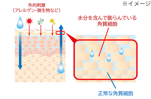 皮膚浸軟とスキントラブルの関係